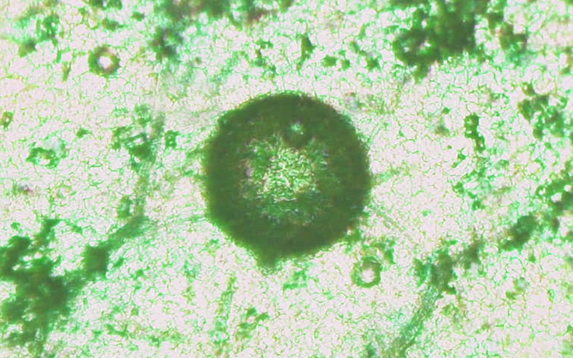 image-immunity.jpg feature image